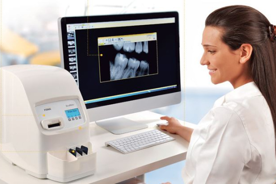 Scaneo – сканер рентгенографических пластин