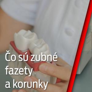 Nový čas, 16.11.2019, téma: Čo sú zubné fazety a korunky